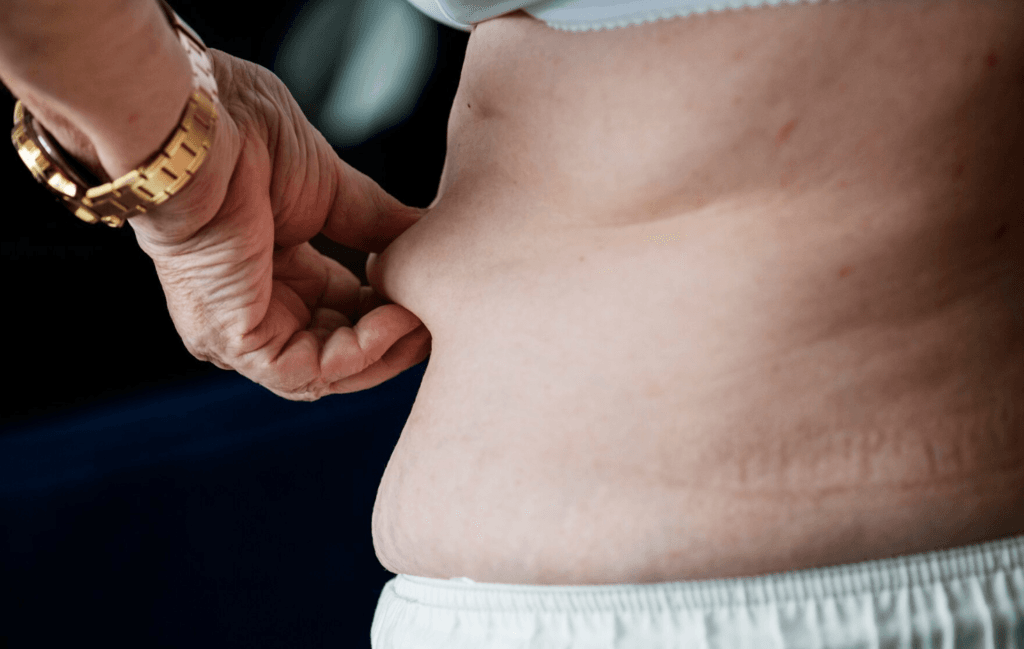 How Are Fats Digested in Our Bodies?